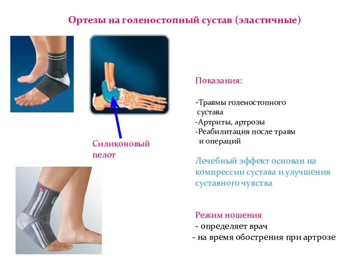 Ортезы на голеностопный сустав (эластичные) Показания: -Травмы голеностопного сустава -Артриты, артрозы -Реабилитация