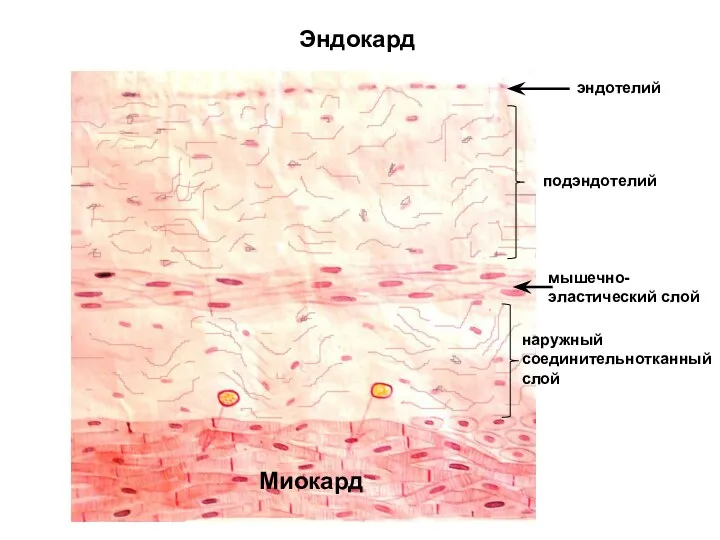 Эндокард Миокард эндотелий подэндотелий мышечно- эластический слой наружный соединительнотканный слой