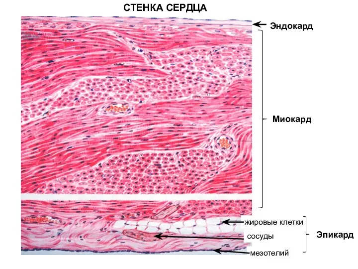 Эндокард Миокард Эпикард жировые клетки сосуды мезотелий СТЕНКА СЕРДЦА