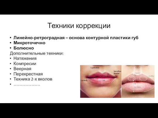 Техники коррекции Линейно-ретроградная – основа контурной пластики губ Микроточечно Болюсно Дополнительные техники: