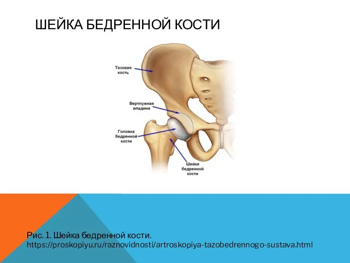ШЕЙКА БЕДРЕННОЙ КОСТИ Рис. 1. Шейка бедренной кости. https://proskopiyu.ru/raznovidnosti/artroskopiya-tazobedrennogo-sustava.html