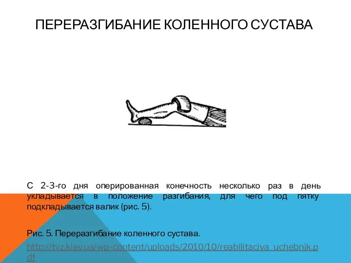 ПЕРЕРАЗГИБАНИЕ КОЛЕННОГО СУСТАВА С 2-3-го дня оперированная конечность несколько раз в день