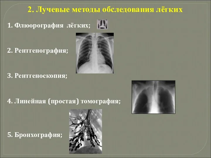 2. Лучевые методы обследования лёгких 1. Флюорография лёгких; 2. Рентгенография; 3. Рентгеноскопия;