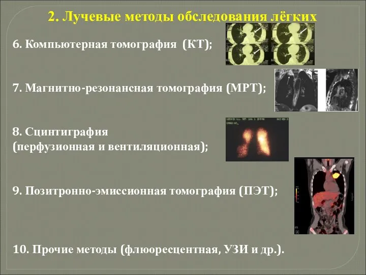 2. Лучевые методы обследования лёгких 6. Компьютерная томография (КТ); 7. Магнитно-резонансная томография