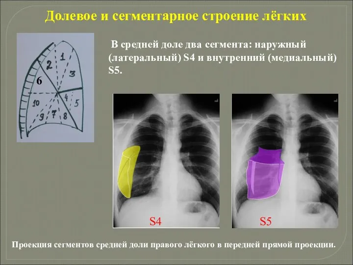 Долевое и сегментарное строение лёгких В средней доле два сегмента: наружный (латеральный)