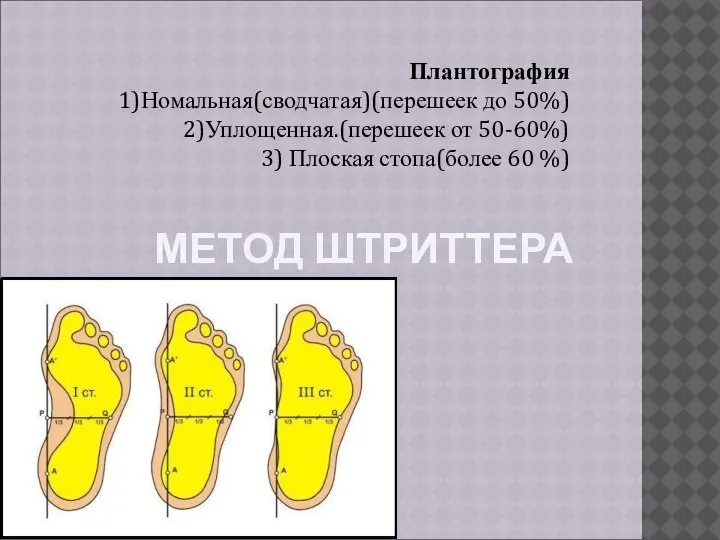 МЕТОД ШТРИТТЕРА Плантография 1)Номальная(сводчатая)(перешеек до 50%) 2)Уплощенная.(перешеек от 50-60%) 3) Плоская стопа(более 60 %)