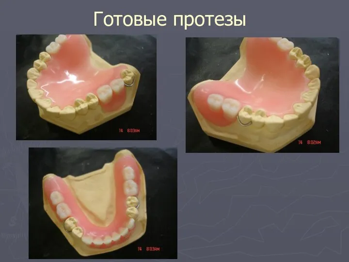 Готовые протезы