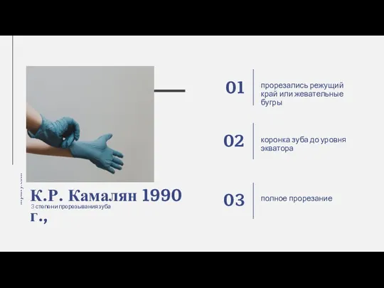 К.Р. Камалян 1990 г., коронка зуба до уровня экватора прорезались режущий край