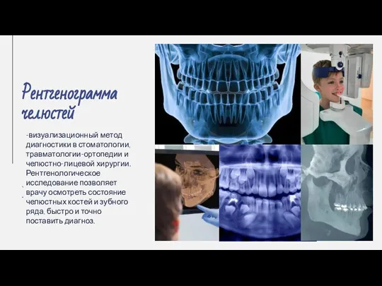 Рентгенограмма челюстей -визуализационный метод диагностики в стоматологии, травматологии-ортопедии и челюстно-лицевой хирургии. Рентгенологическое