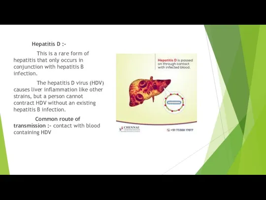 Hepatitis D :- This is a rare form of hepatitis that only