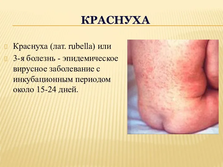 КРАСНУХА Краснуха (лат. rubella) или 3-я болезнь - эпидемическое вирусное заболевание с