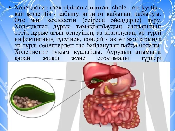 Холецистит грек тілінен алынған, chole - өт, kystis - қап және itis