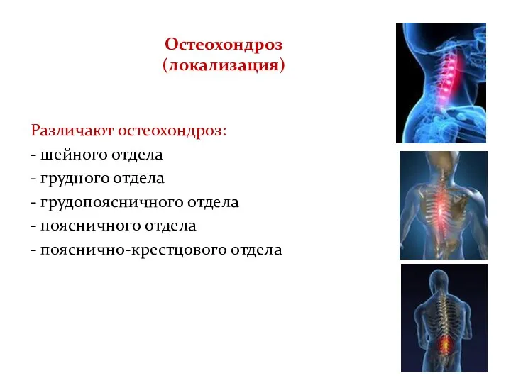 Остеохондроз (локализация) Различают остеохондроз: - шейного отдела - грудного отдела - грудопоясничного