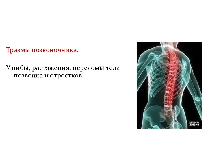 Травмы позвоночника. Ушибы, растяжения, переломы тела позвонка и отростков.