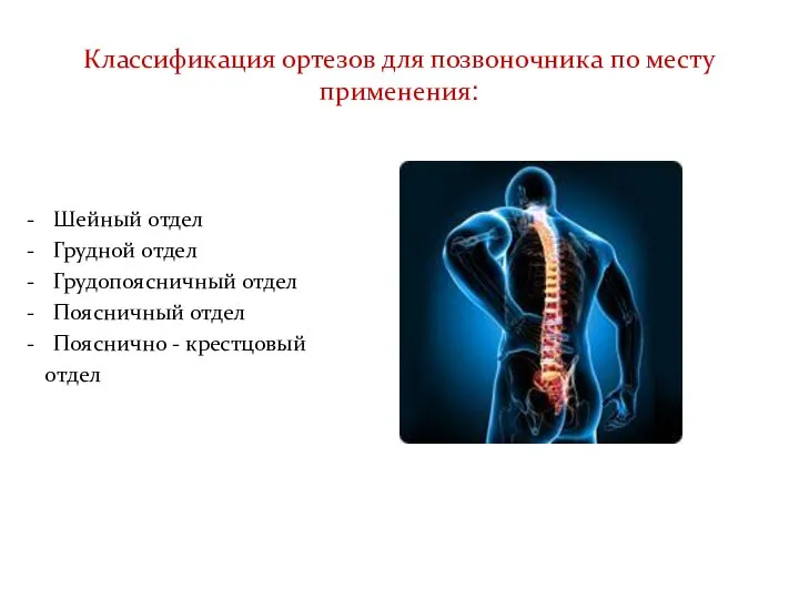 Классификация ортезов для позвоночника по месту применения: Шейный отдел Грудной отдел Грудопоясничный