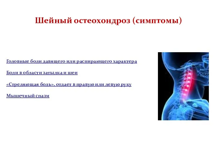 Шейный остеохондроз (симптомы) Головные боли давящего или распирающего характера Боли в области