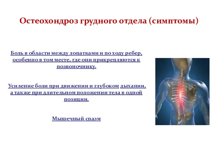 Остеохондроз грудного отдела (симптомы) Боль в области между лопатками и по ходу
