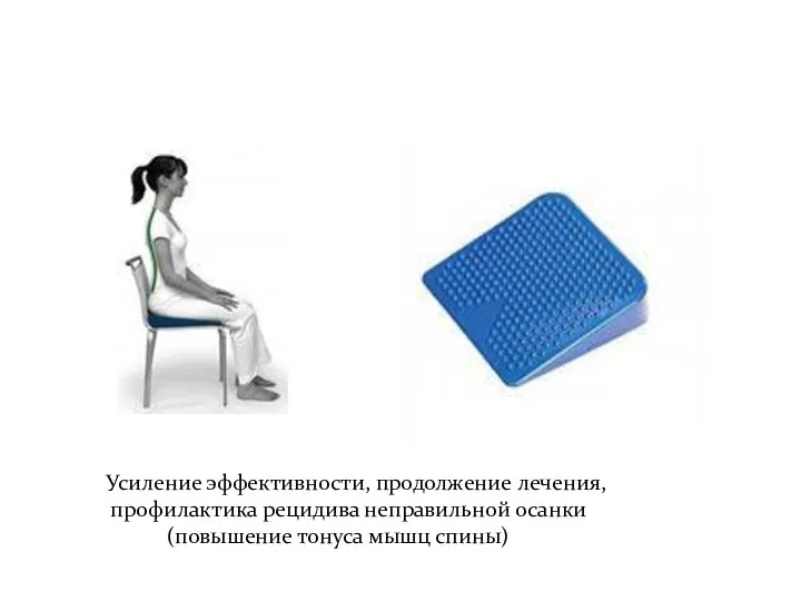 Усиление эффективности, продолжение лечения, профилактика рецидива неправильной осанки (повышение тонуса мышц спины)