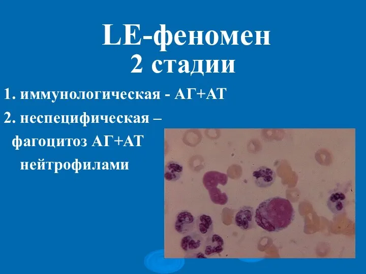 LE-феномен 2 стадии 1. иммунологическая - АГ+АТ 2. неспецифическая – фагоцитоз АГ+АТ нейтрофилами