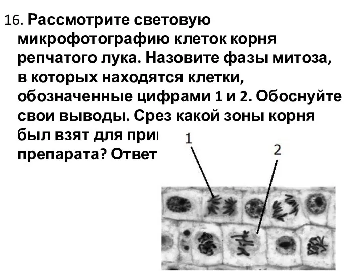 16. Рассмотрите световую микрофотографию клеток корня репчатого лука. Назовите фазы митоза, в