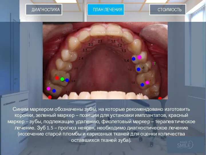 ПЛАН ЛЕНИЯ СТОИМОСТЬ ПЛАН ЛЕЧЕНИЯ ДИАГНОСТИКА Синим маркером обозначены зубы, на которые