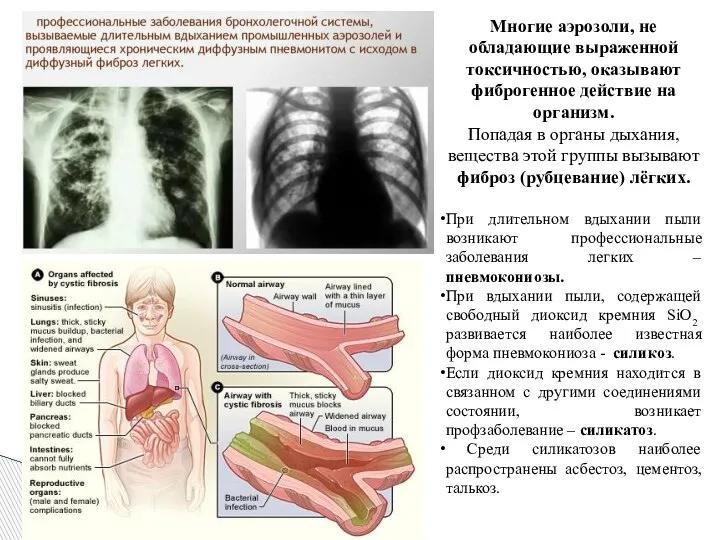 Многие аэрозоли, не обладающие выраженной токсичностью, оказывают фиброгенное действие на организм. Попадая