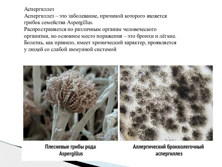 Аспергиллез Аспергиллез – это заболевание, причиной которого является грибок семейства Aspergillus. Распространяется
