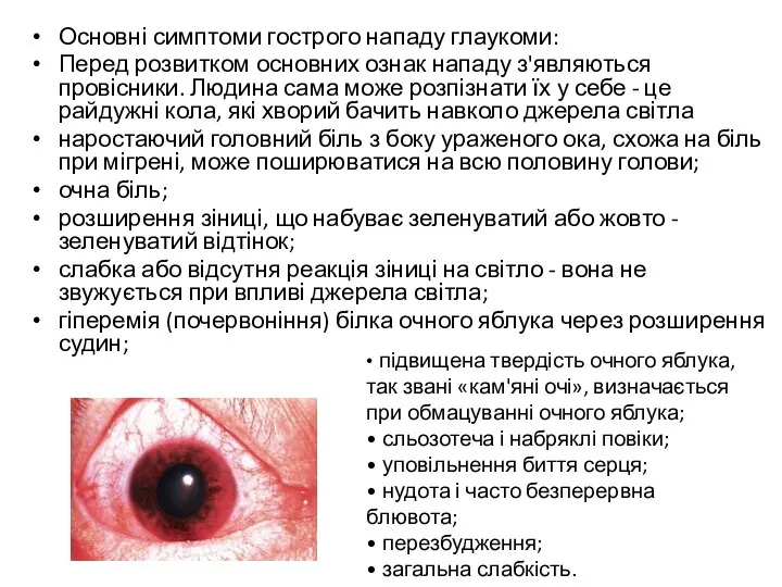 Основні симптоми гострого нападу глаукоми: Перед розвитком основних ознак нападу з'являються провісники.