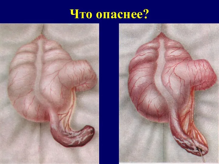 Что опаснее?