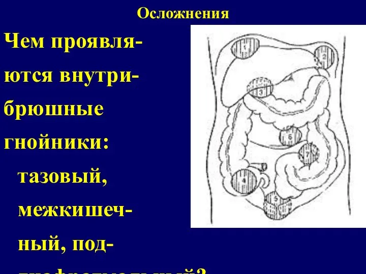 Осложнения Чем проявля- ются внутри- брюшные гнойники: тазовый, межкишеч- ный, под- диафрагмальный?