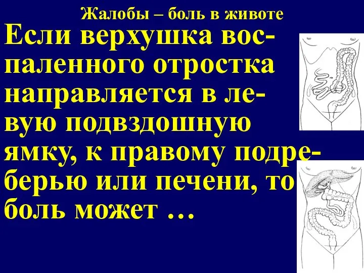 Если верхушка вос- паленного отростка направляется в ле- вую подвздошную ямку, к