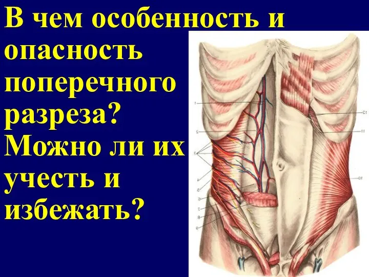 В чем особенность и опасность поперечного разреза? Можно ли их учесть и избежать?