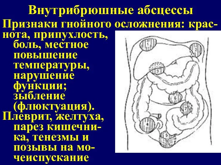 Внутрибрюшные абсцессы Признаки гнойного осложнения: крас-нота, припухлость, боль, местное повышение температуры, нарушение