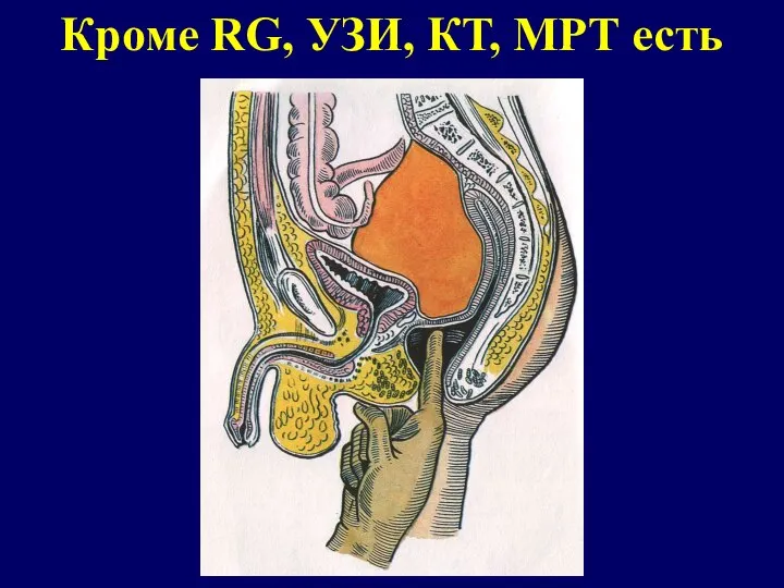 Кроме RG, УЗИ, КТ, МРТ есть