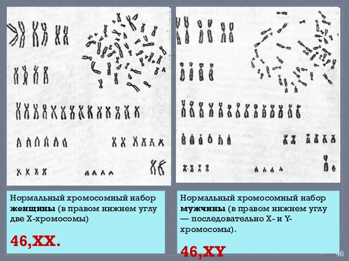 Нормальный хромосомный набор женщины (в правом нижнем углу две X-хромосомы) 46,ХХ. Нормальный