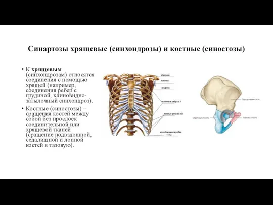 Синартозы хрящевые (синхондрозы) и костные (синостозы) К хрящевым (синхондрозам) относятся соединения с