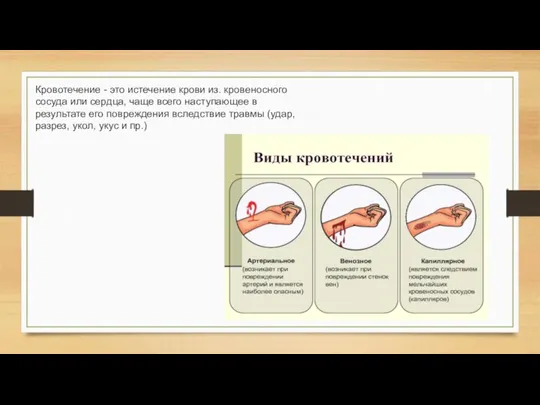 Кровотечение - это истечение крови из. кровеносного сосуда или сердца, чаще всего