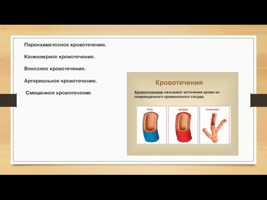 Паренхиматозное кровотечение. Капиллярное кровотечение. Венозное кровотечение. Артериальное кровотечение. Смешанное кровотечение.