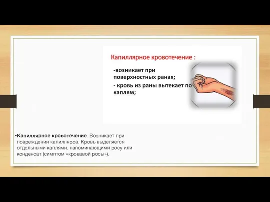 Капиллярное кровотечение. Возникает при повреждении капилляров. Кровь выделяется отдельными каплями, напоминающими росу