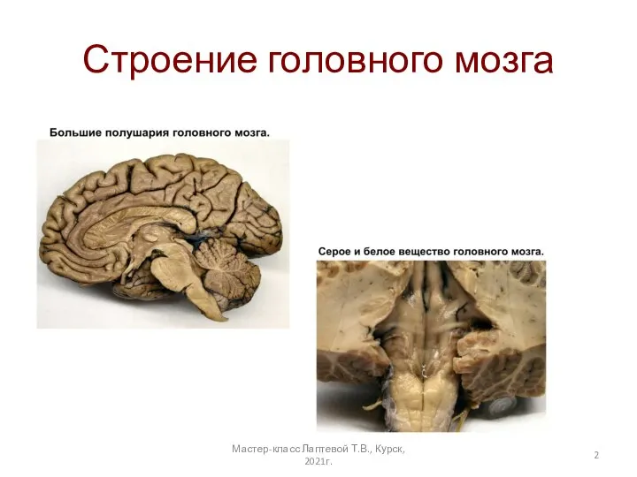 Строение головного мозга Мастер-класс Лаптевой Т.В., Курск, 2021г.