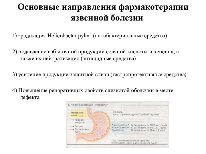 Основные направления фармакотерапии язвенной болезни 1) эрадикация Helicobacter pylori (антибактериальные средства) 2)