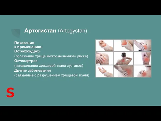 Артогистан (Artogystan) Показания к применению: Остеохондроз (поражение хряща межпозвоночного диска) Остеоартроз (изнашивание