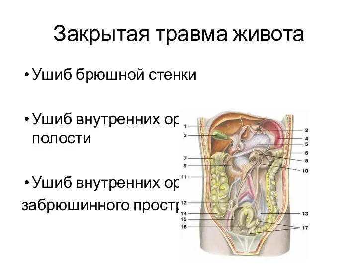 Закрытая травма живота Ушиб брюшной стенки Ушиб внутренних органов брюшной полости Ушиб внутренних органов забрюшинного пространства
