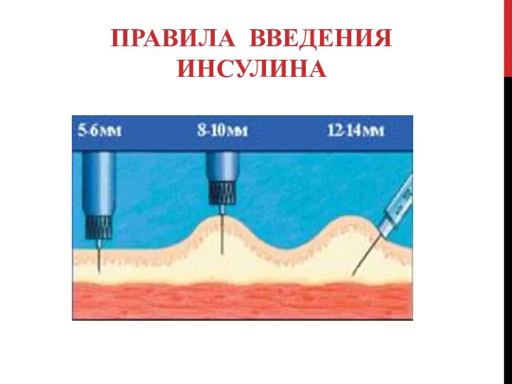 ПРАВИЛА ВВЕДЕНИЯ ИНСУЛИНА