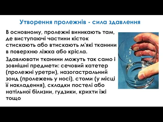 Утворення пролежнів - сила здавлення В основному, пролежні виникають там, де виступаючі