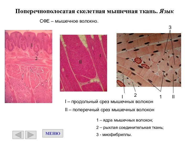 Поперечнополосатая скелетная мышечная ткань. Язык I – продольный срез мышечных волокон II