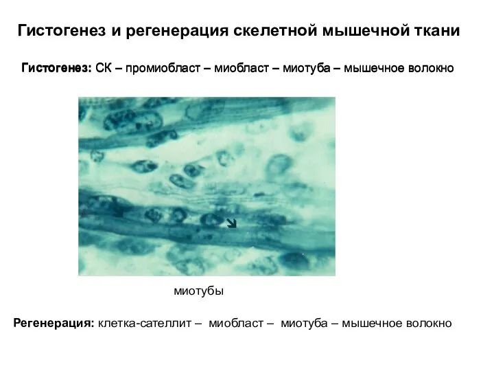 Гистогенез и регенерация скелетной мышечной ткани миотубы Регенерация: клетка-сателлит – миобласт –