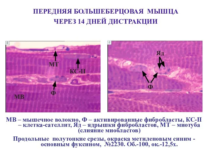 МВ – мышечное волокно, Ф – активированные фибробласты, КС-II – клетка-сателлит, Яд