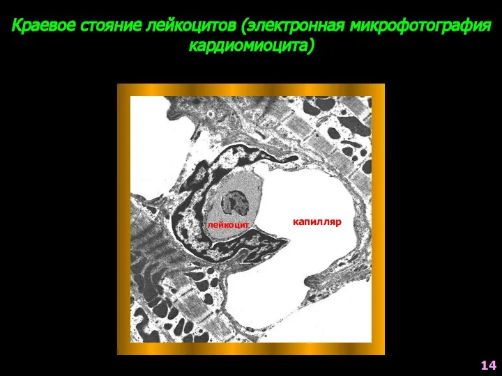 Краевое стояние лейкоцитов (электронная микрофотография кардиомиоцита) лейкоцит капилляр 14