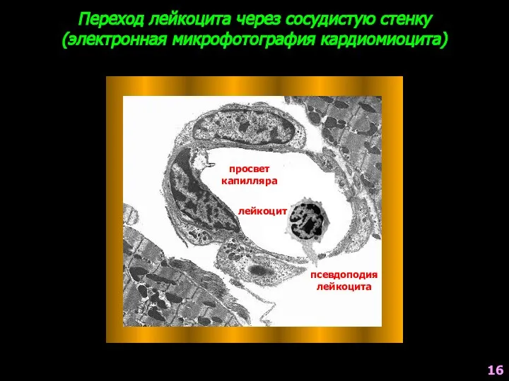 Переход лейкоцита через сосудистую стенку (электронная микрофотография кардиомиоцита) лейкоцит просвет капилляра псевдоподия лейкоцита 16